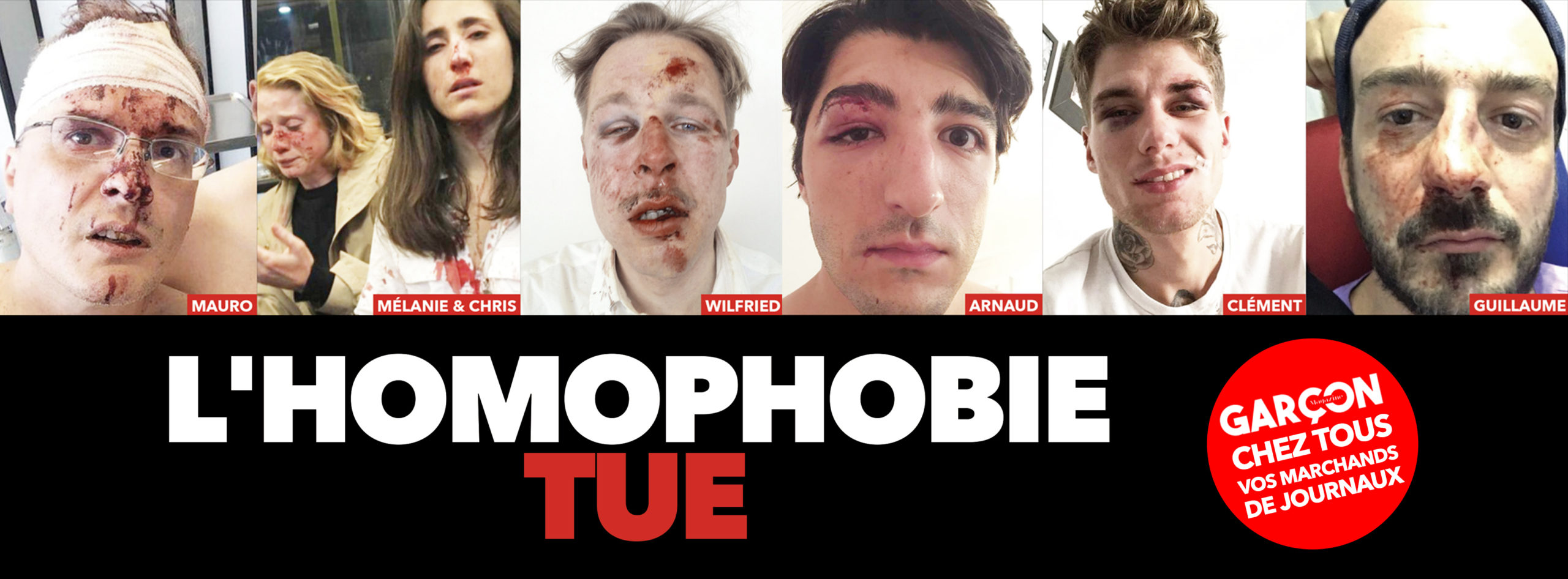 Garçon Magazine lutte contre l’homophobie